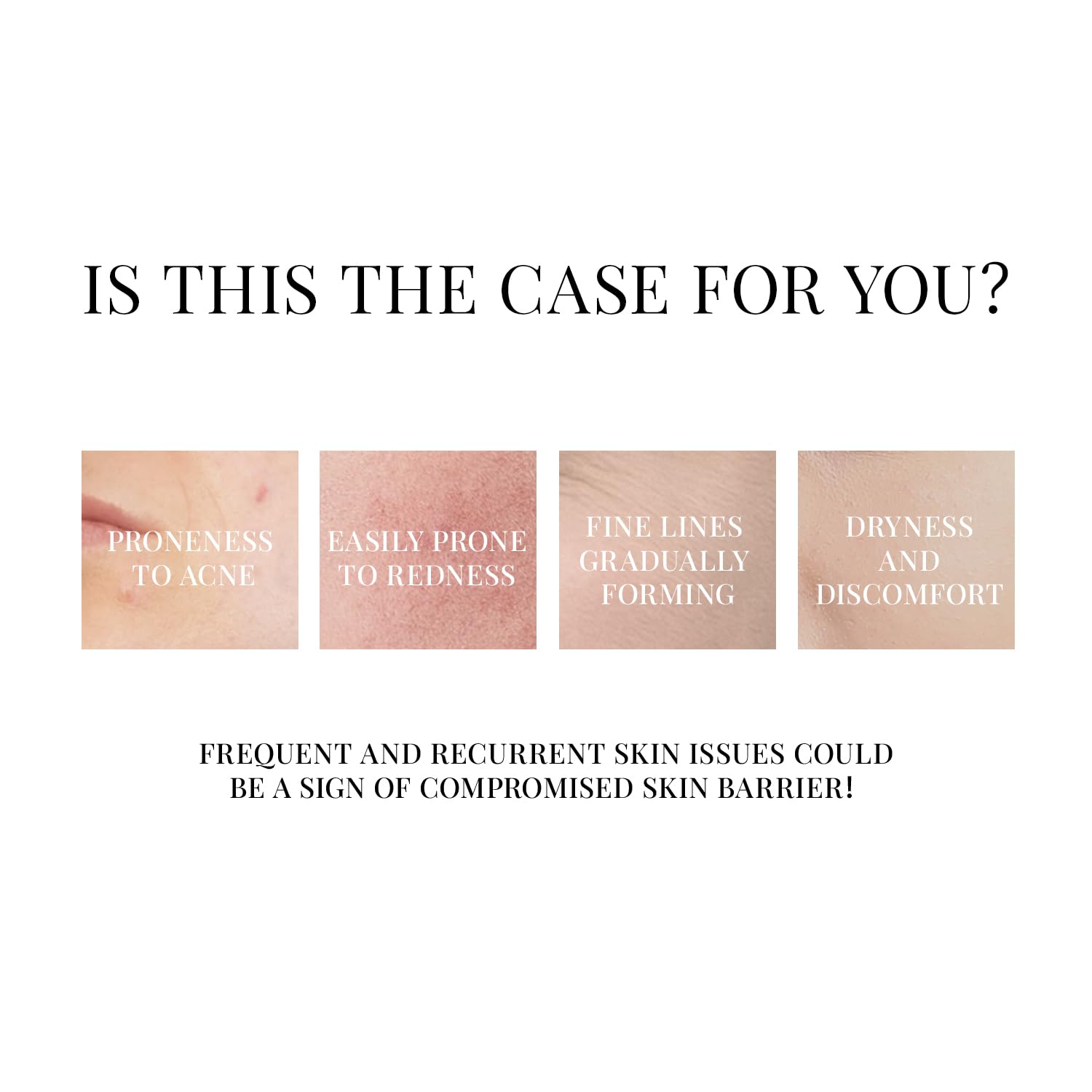 +WIS+ Hyaluronic Acid Face Mask 24 EA with Hyaluronic Acid Serum and Vitamin B5, Hydrating Facial Mask for Dry Skin, Anti-Aging Mask to Plump and Repair Dehydrated Skin, Safe on Sensitive Skin - Image 3