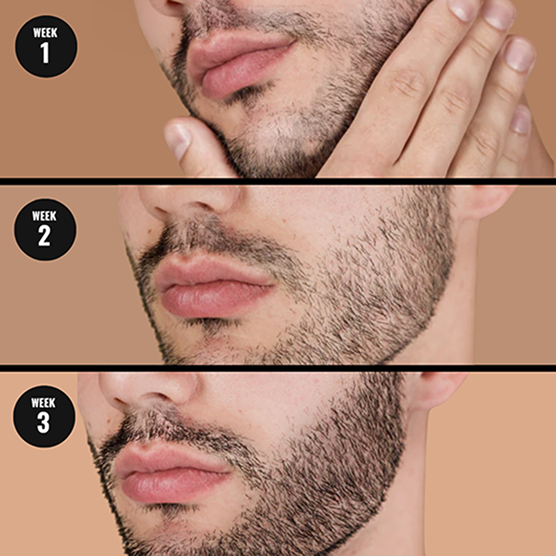 Beard Growth Oil - 5X Value Pack - Image 8