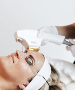 BBL Photofacial