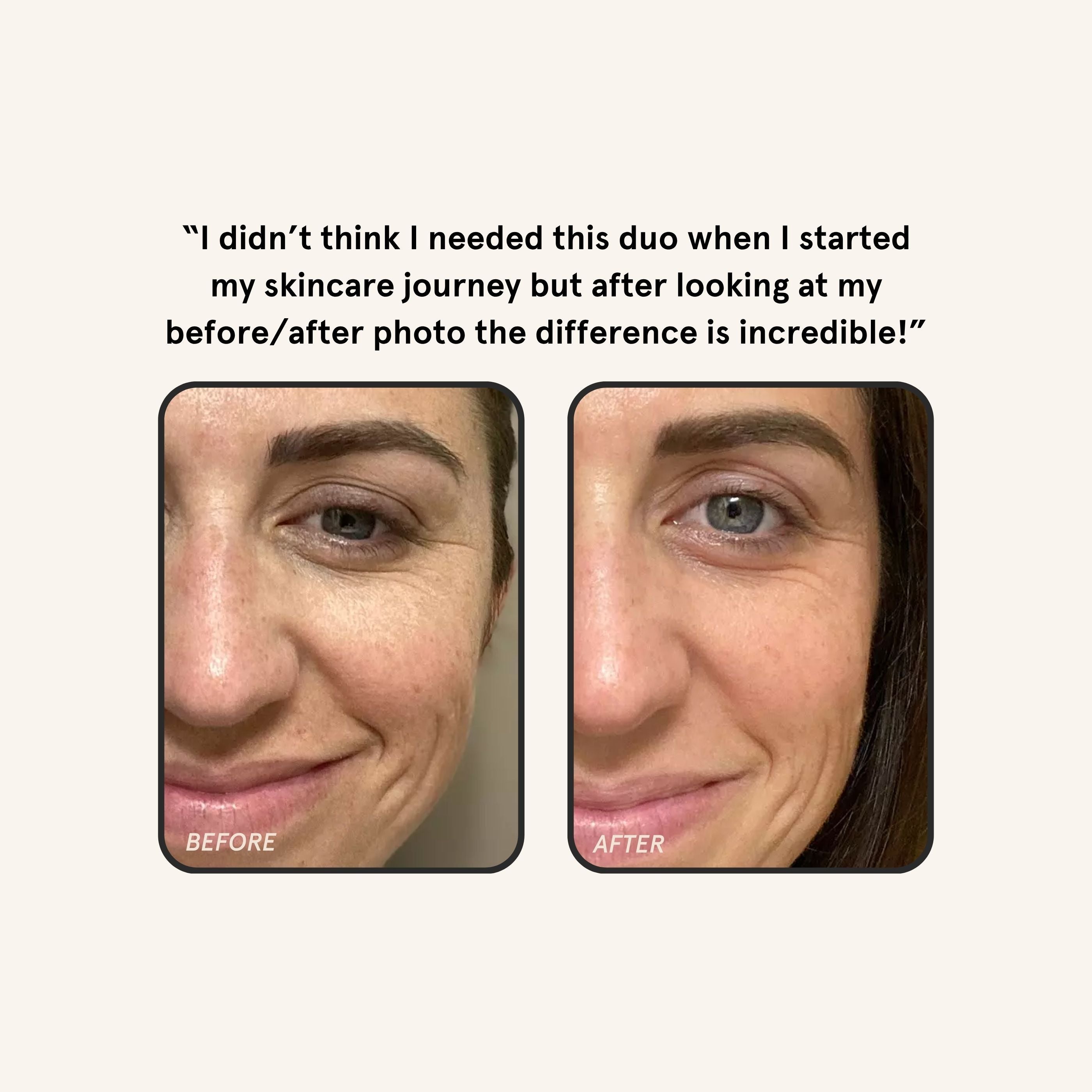 Brightening Duo - Image 4