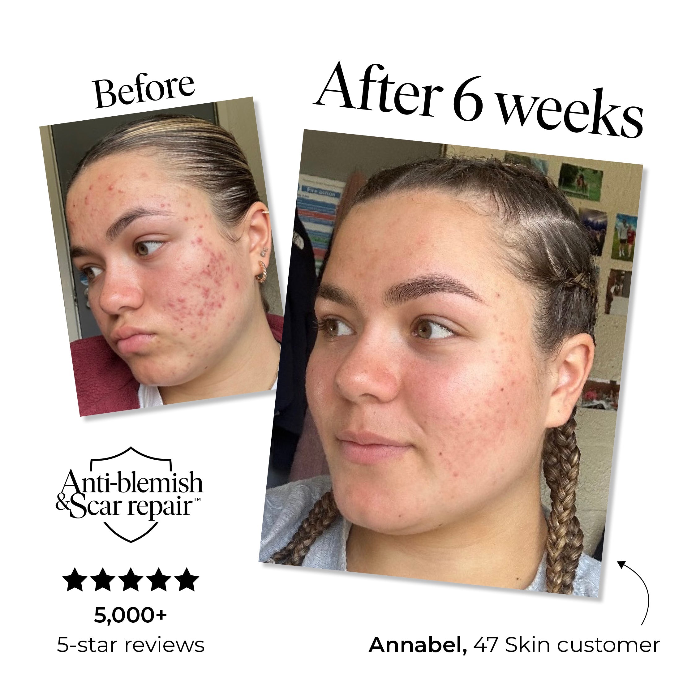 Anti-Blemish & Scar Repair Serum - Image 2