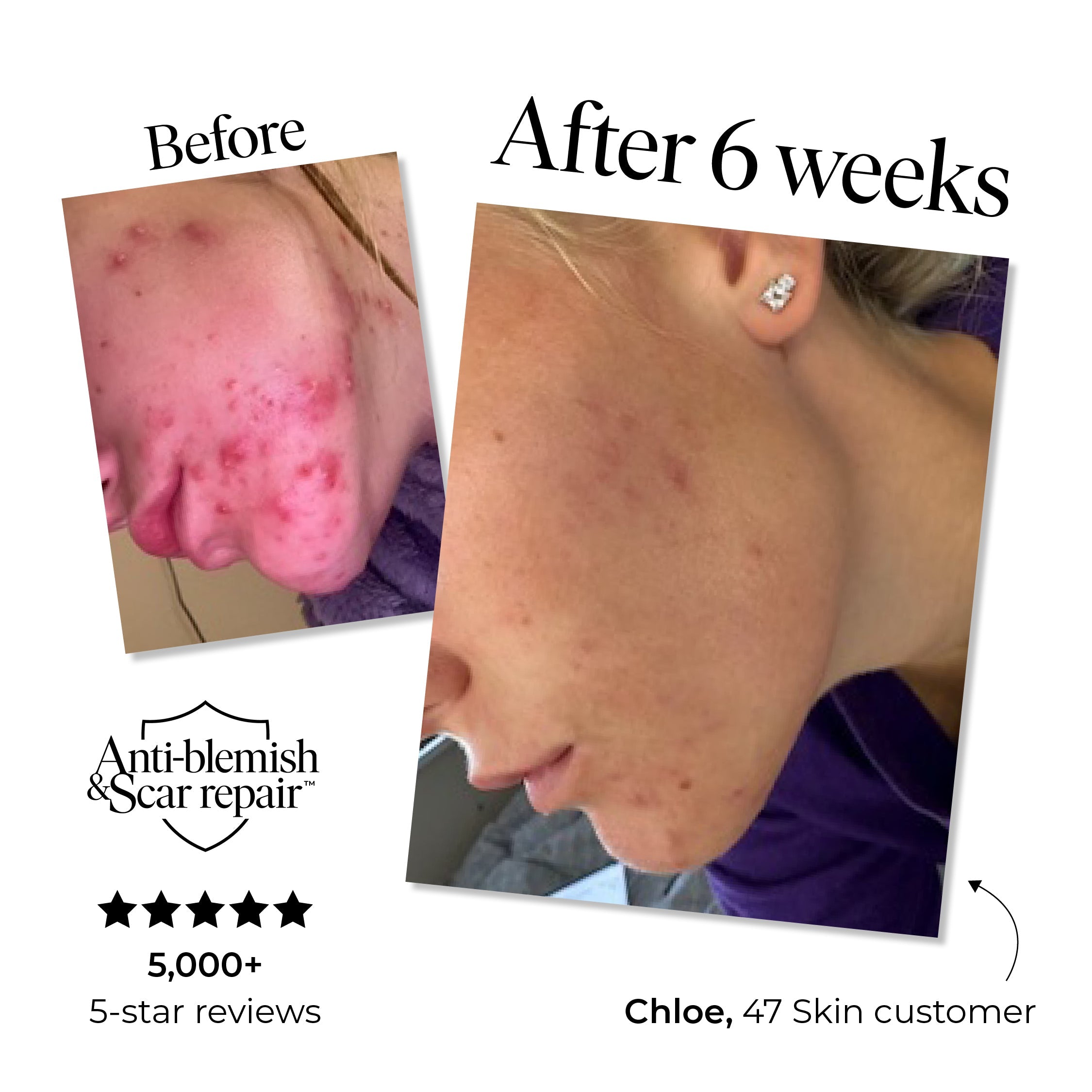 2 Step Treatment Set - Image 2