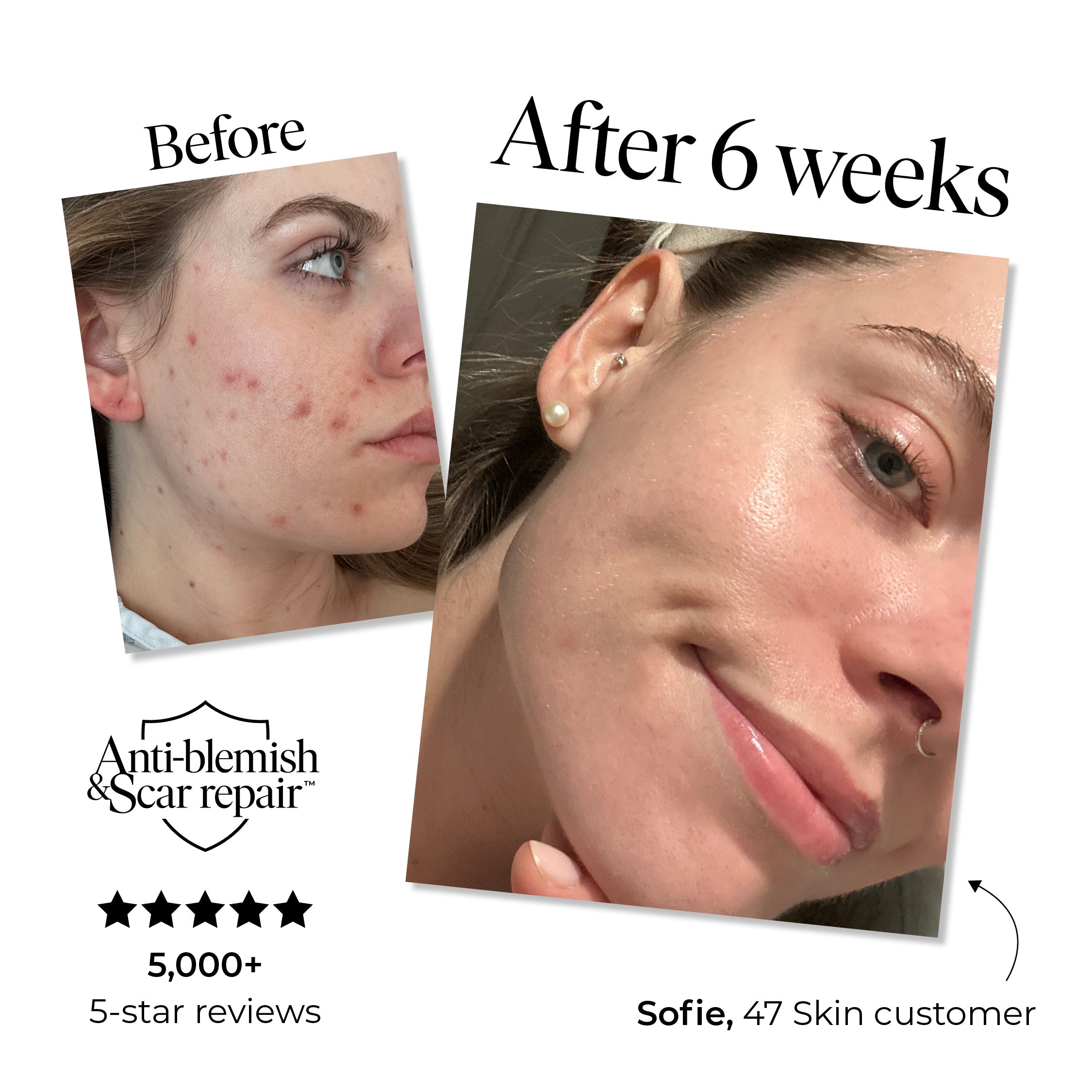 3 Step Moisture Set - Image 2