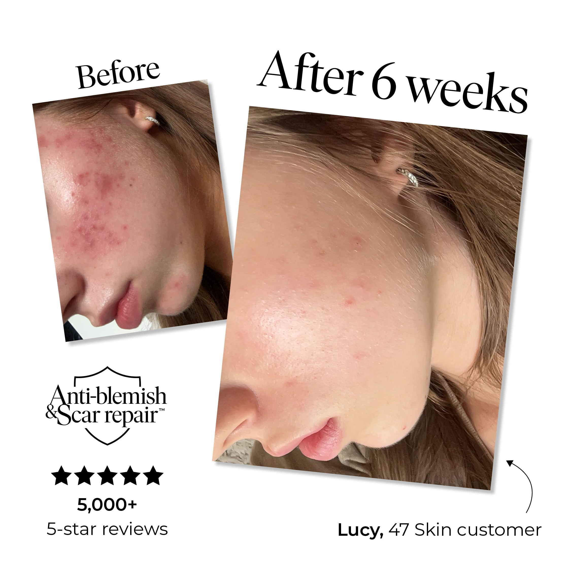 3 Step Treatment Set - Image 2