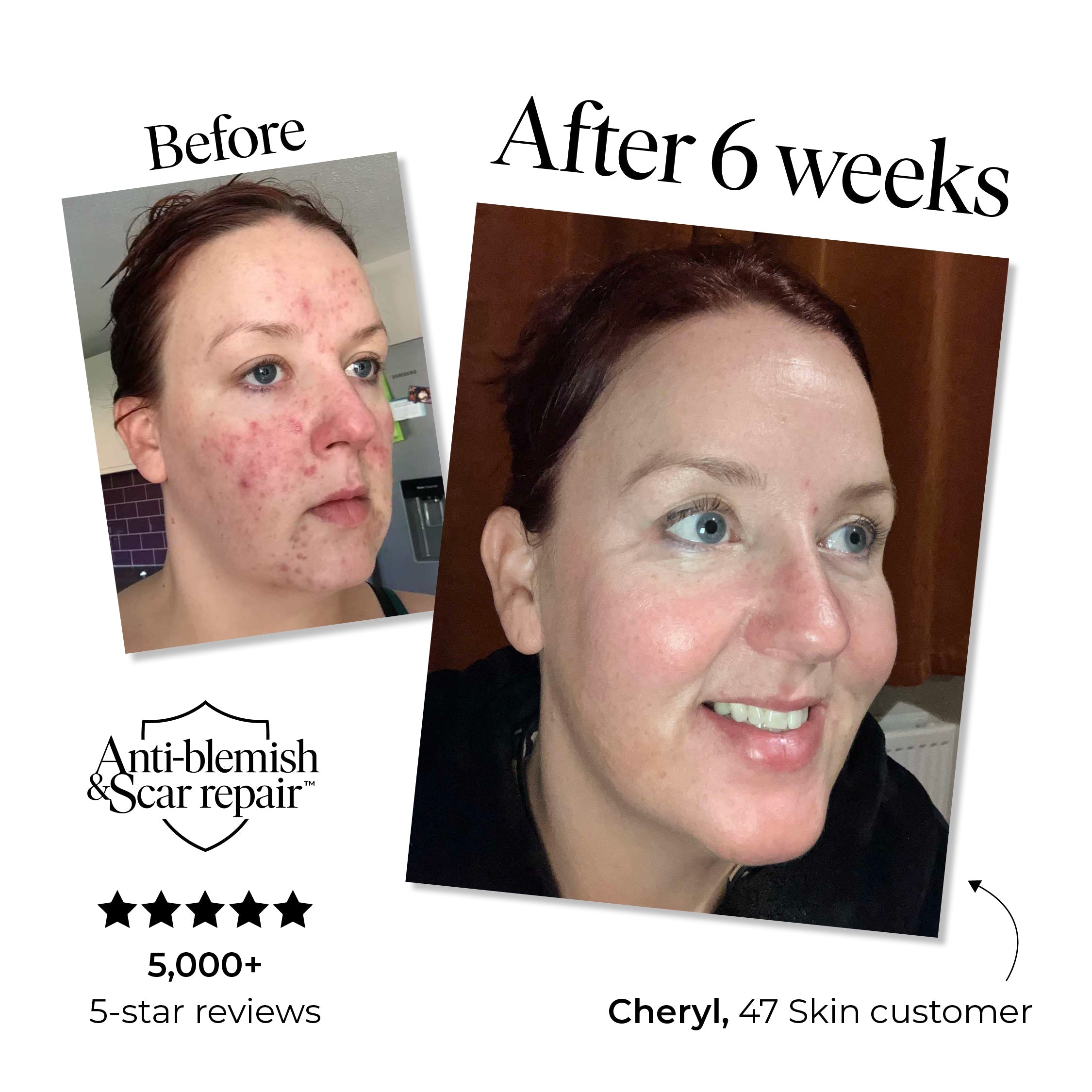 Anti-Blemish and Scar Repair Silver Mask - Image 2